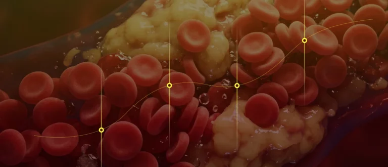 Why Most Cholesterol Tests Miss Heart Disease